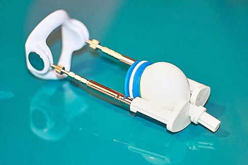 Extenseur - un appareil pour une augmentation efficace d'un membre